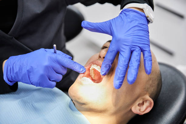 Best Emergency Tooth Extraction in Seabrook, TX